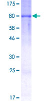 12.5% SDS-PAGE Stained with Coomassie Blue.